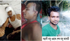 নোয়াখালীর সোনাইমুরীতে মুরগীর খামারের সামনে ককটেল ফোটাতে নিষেধ করায় মোঃ রাজু ও ওমর ফারুক নামের দুই যুবককে কুপিয়ে গুরুতর যক্ষম করে বখাটে ও সন্ত্রাসী বাবু ওরফে শেখ বাবু।