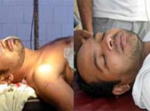 রাবিতে প্রকাশ্যে শিবিরের সন্ত্রাস, ছাত্রলীগ নেতার পায়ের রগ কর্তন, বেপরোয়া হামলায় আর এক নেতা গুলিবিদ্ধ ॥ ক্যাম্পাসে উত্তেজনা, মহাসড়ক অবরোধ